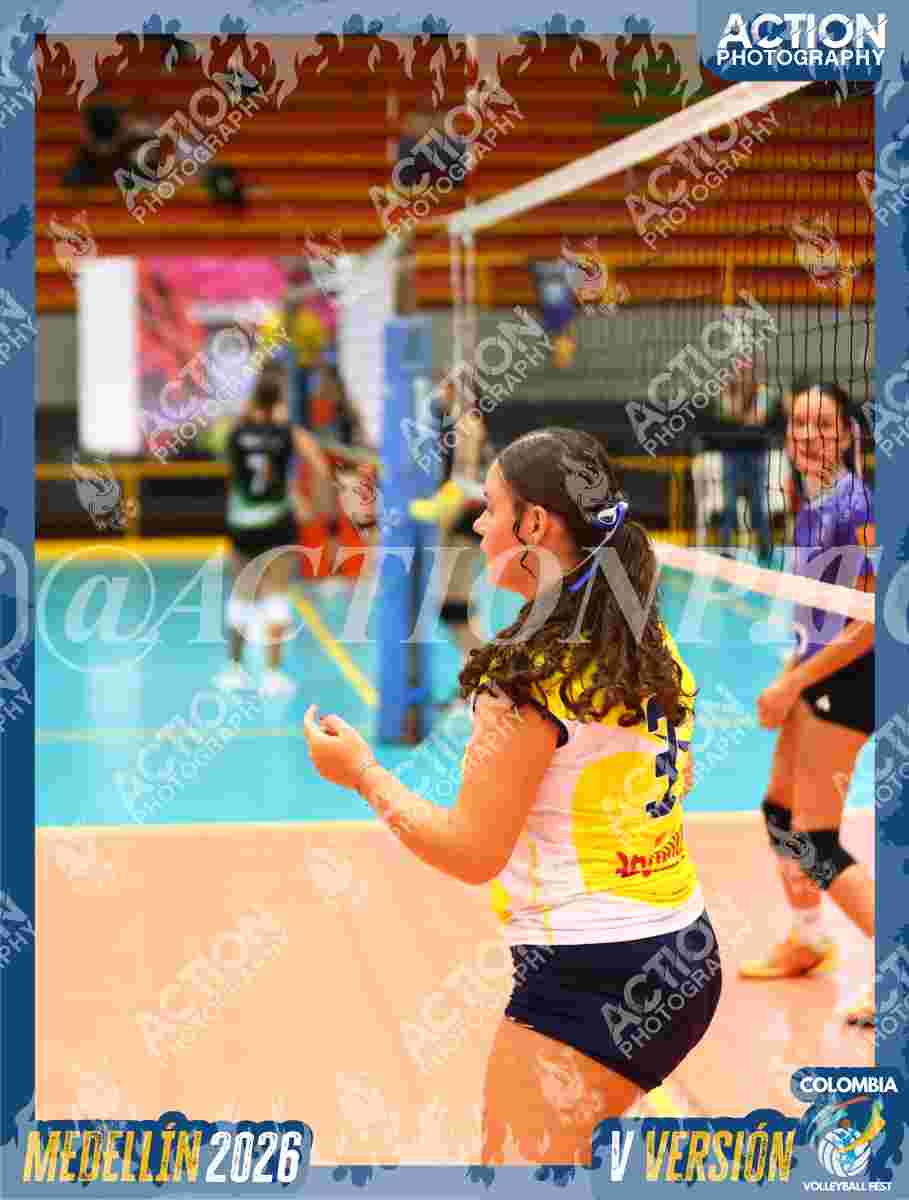 Preview de ETVMR