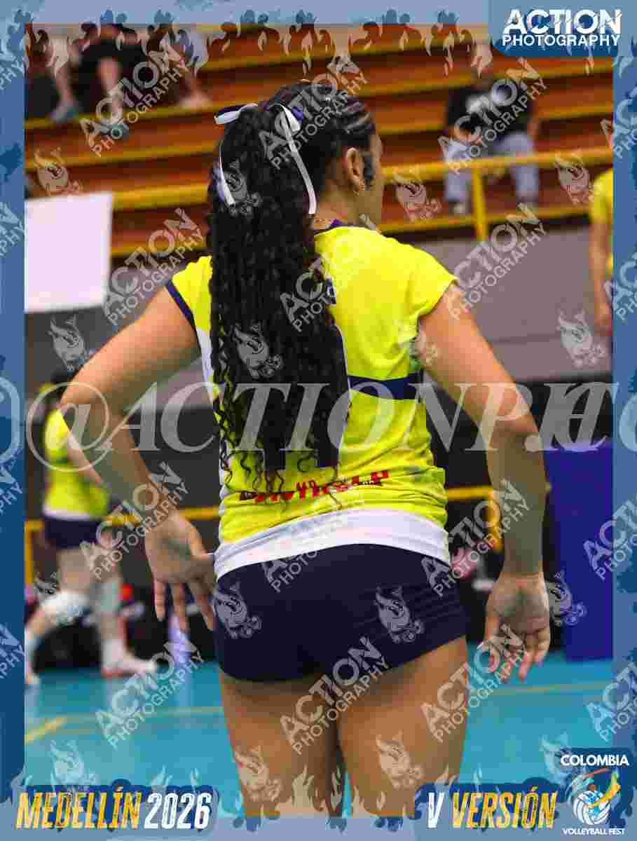 Preview de ETVMR